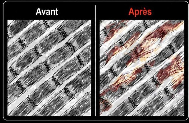 Fibres musculaires avant et après l'effort : apparition de microlésions et d'inflammation en rouge